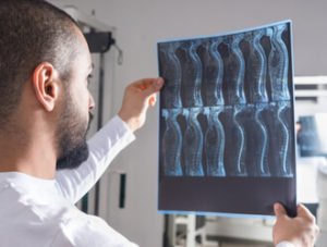 living with a spinal cord injury is often expensive