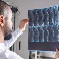 living-with-a-spinal-cord-injury-is-often-expensive.jpg living-with-a-spinal-cord-injury-is-often-expensive.jpg