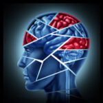 BrainInjury1 BrainInjury1