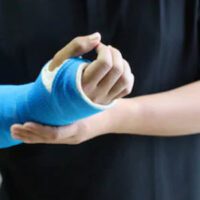 InjuredArm InjuredArm