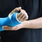 InjuredArm InjuredArm